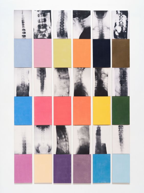 Installation view, x-ray island, Moskowitz Bayse · 2026 (14)