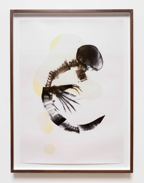 Installation view, x-ray island, Moskowitz Bayse